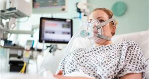 Coronavirus: F1 teams rally to build ventilators for NHS